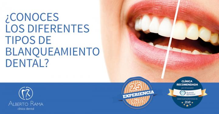 CLINICA DENTAL ALBERTO RAMA - ESPECIALISTAS EN BLANQUEAMIENTO DENTAL