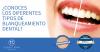 CLINICA DENTAL ALBERTO RAMA - ESPECIALISTAS EN BLANQUEAMIENTO DENTAL